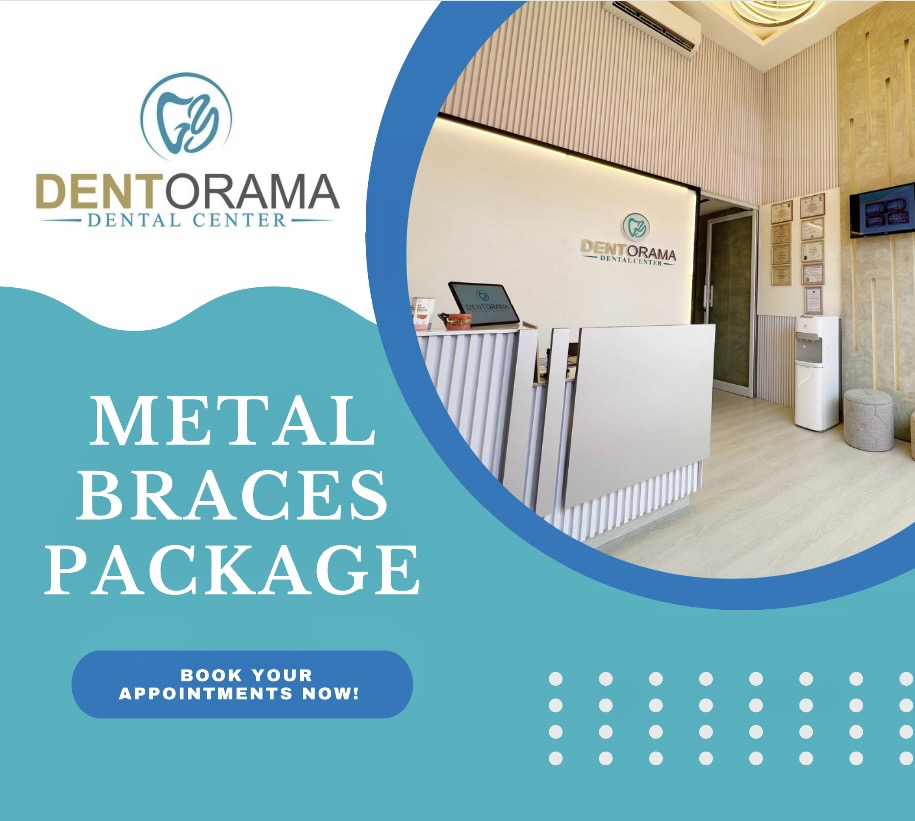 Dentorama Dental Center - Calapan Facebook ad: Chat in Messenger