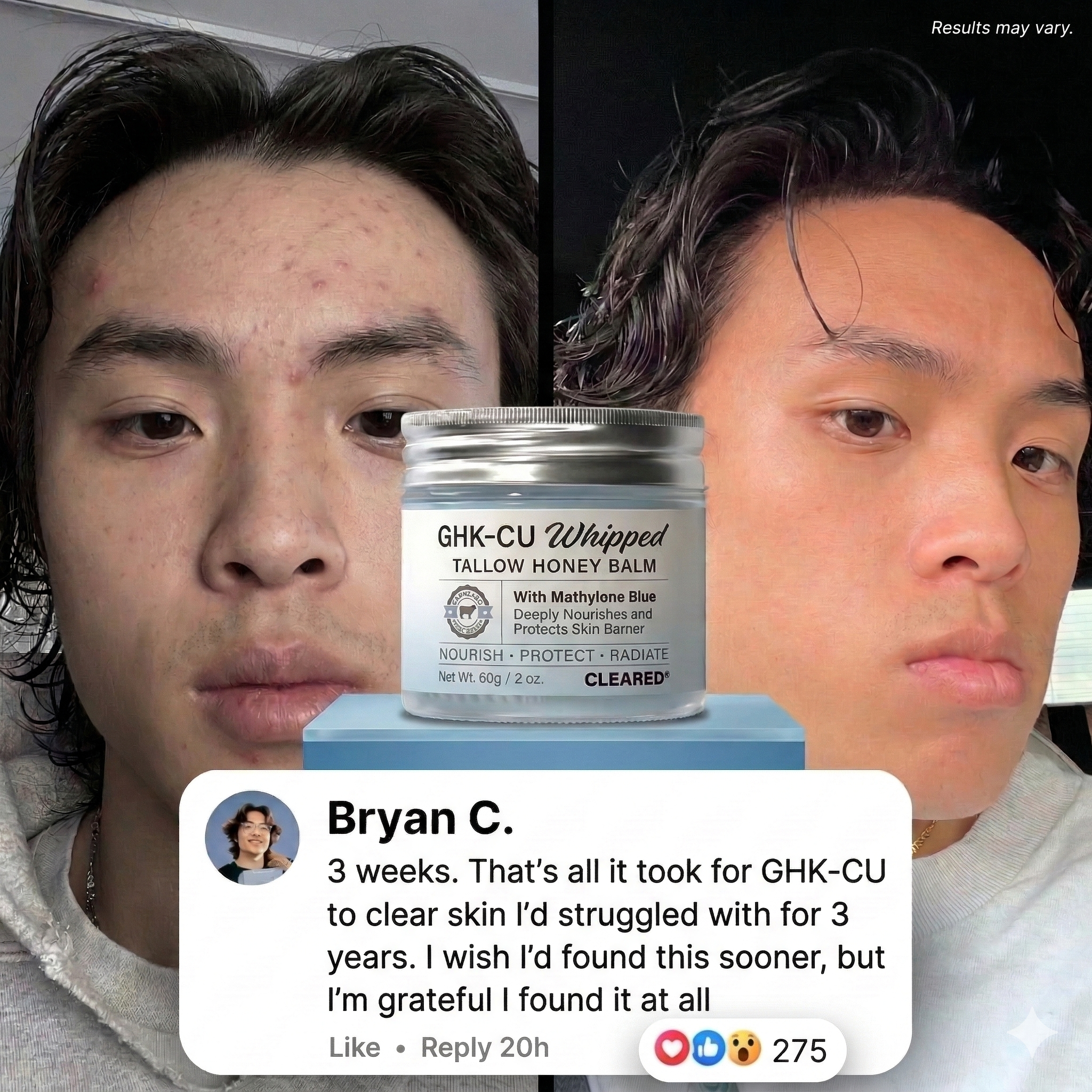 TryCleared Co. Facebook ad: Upgrade Your Skin, 53% Off