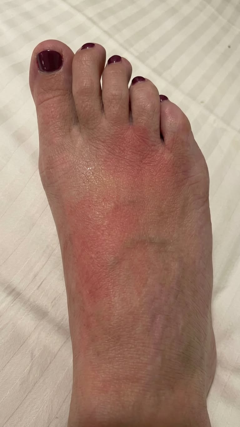 Jennifer Thompson Facebook ad: why your feet ache for days