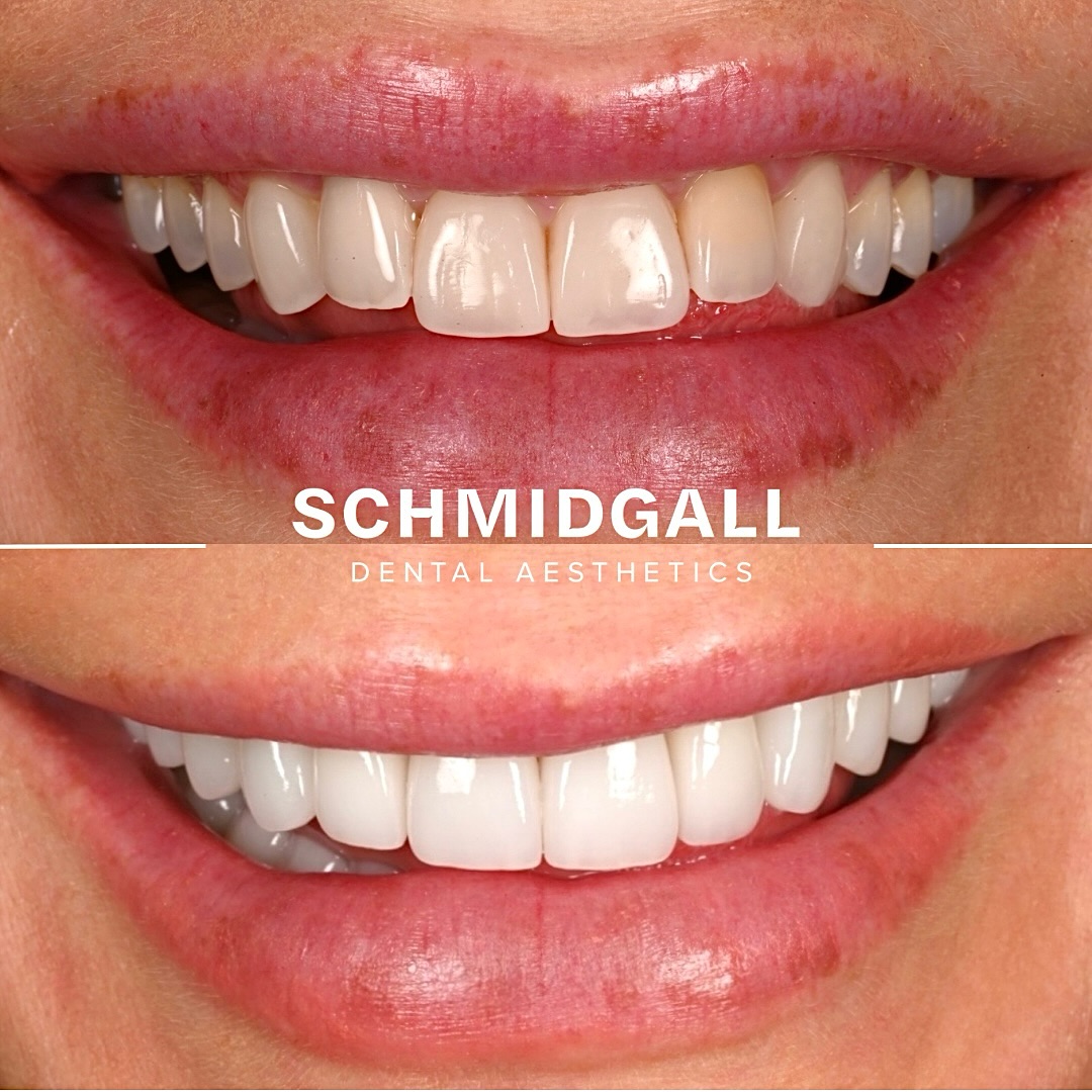 Dr. Ryan Schmidgall Facebook ad