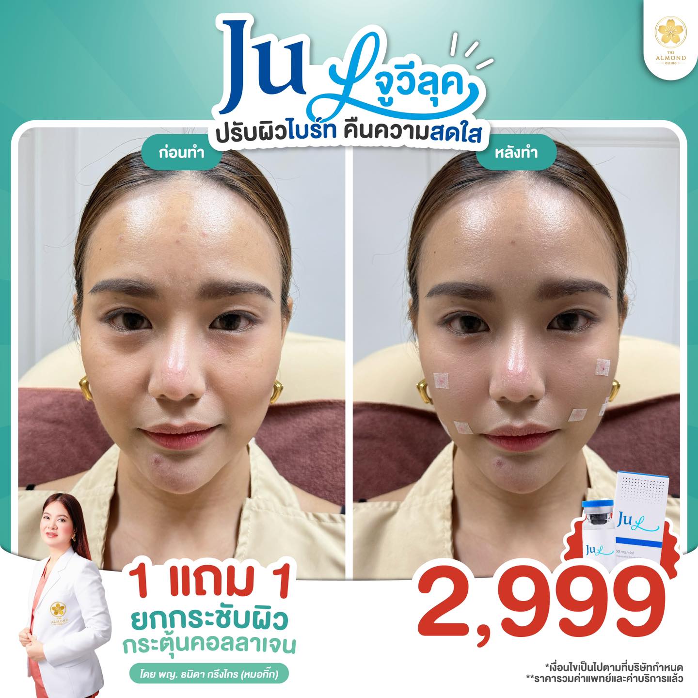 The Almond Clinic Facebook ad
