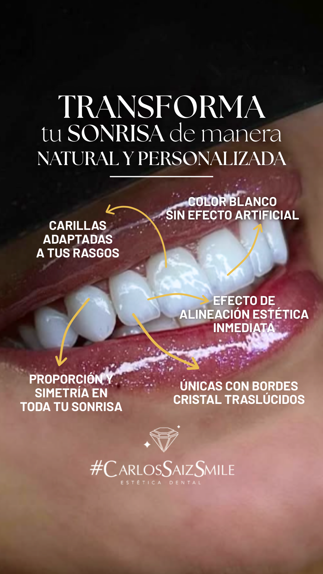 Estética Dental - Carlos Saiz Smile Facebook ad from Jan 12, 2026