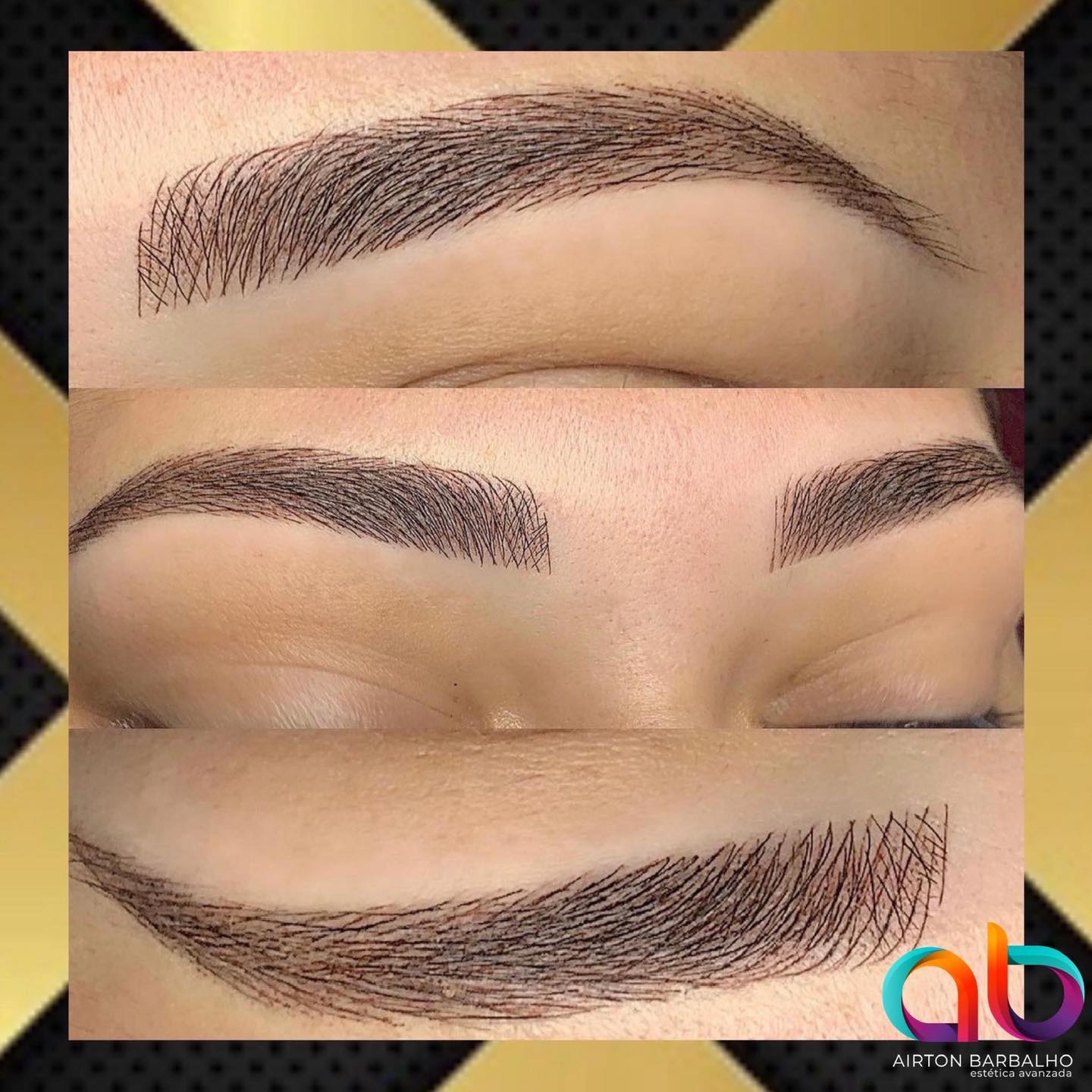 AB Estética Avanzada Facebook ad