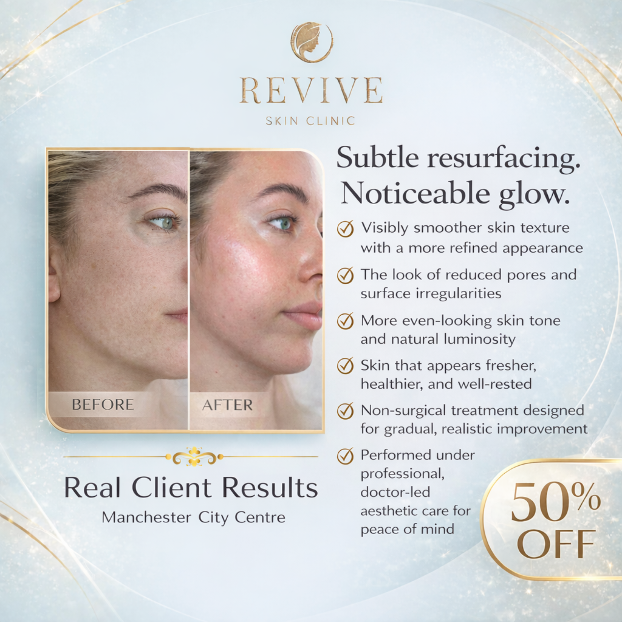 Revive - Skin Clinic Facebook ad: 50% Off CO2 Laser at Revive! Bye wrinkles & scars!