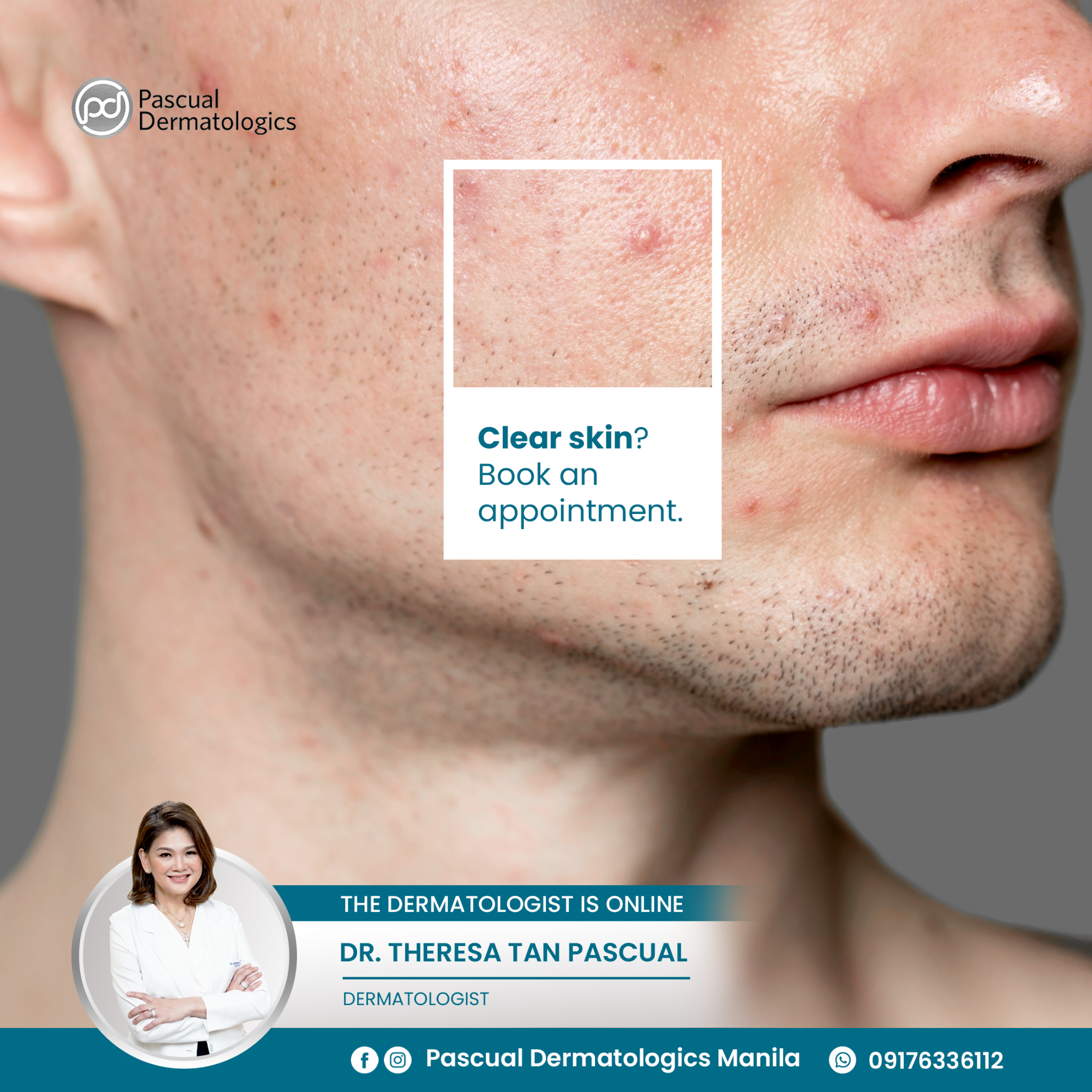 Pascual Dermatologics Manila Facebook ad: HMO Accepted - Book Now!
