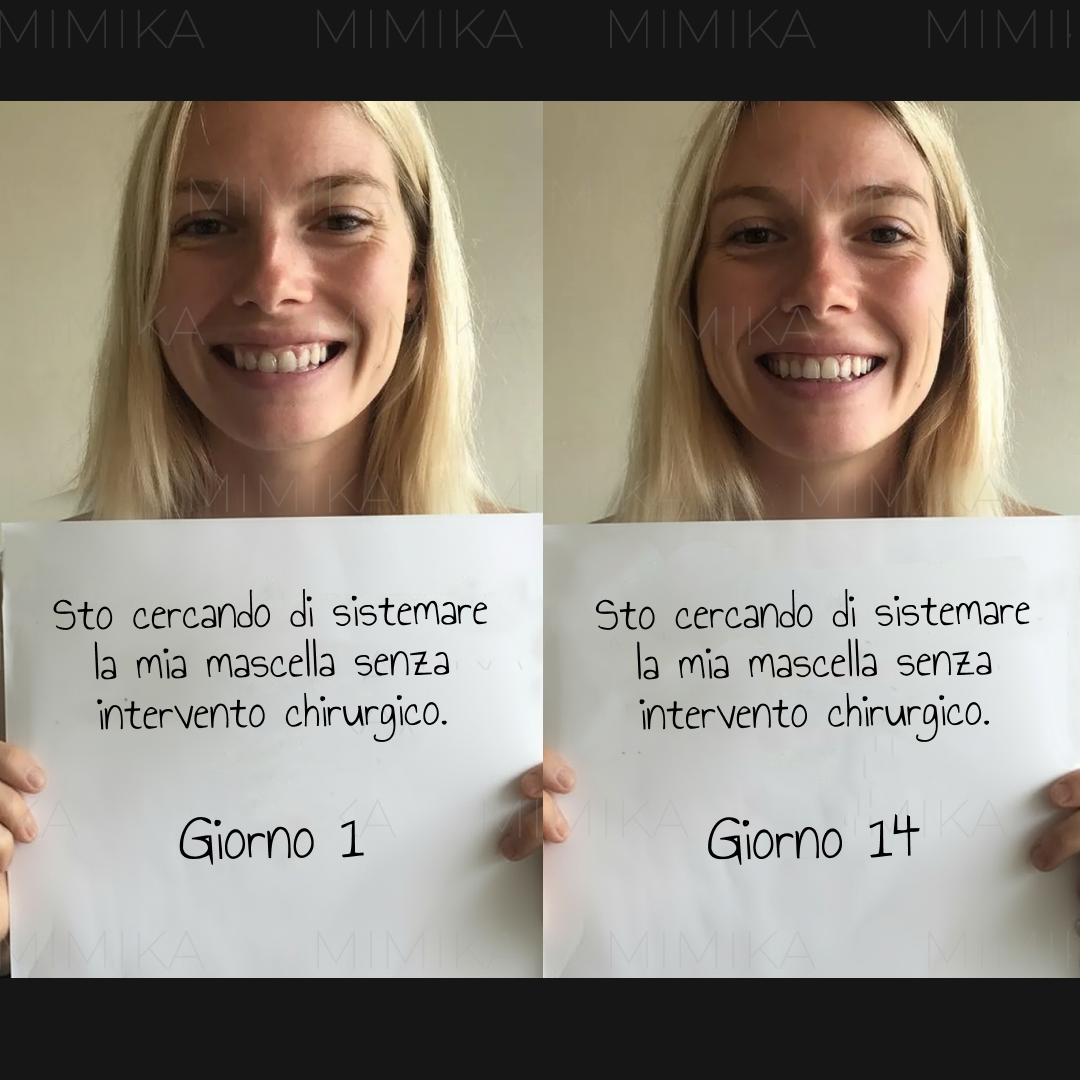 Mimika - Face Yoga Exercises Facebook ad