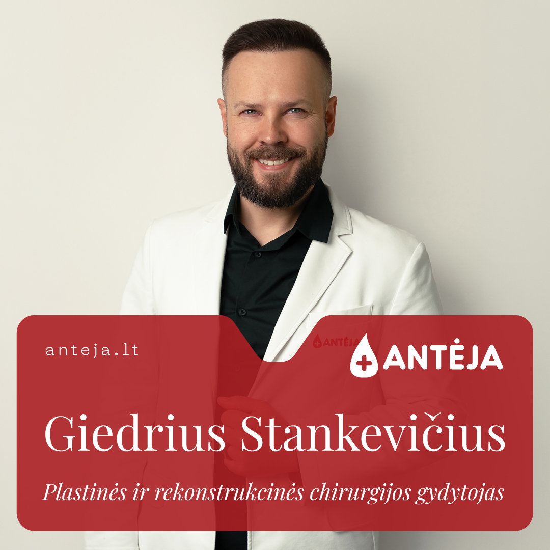 Antėja Facebook ad