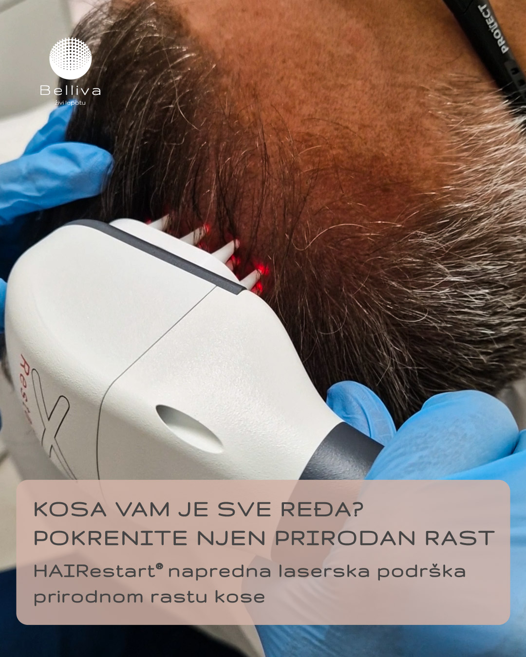 Belliva Facebook ad: Šta je HAIRestart?