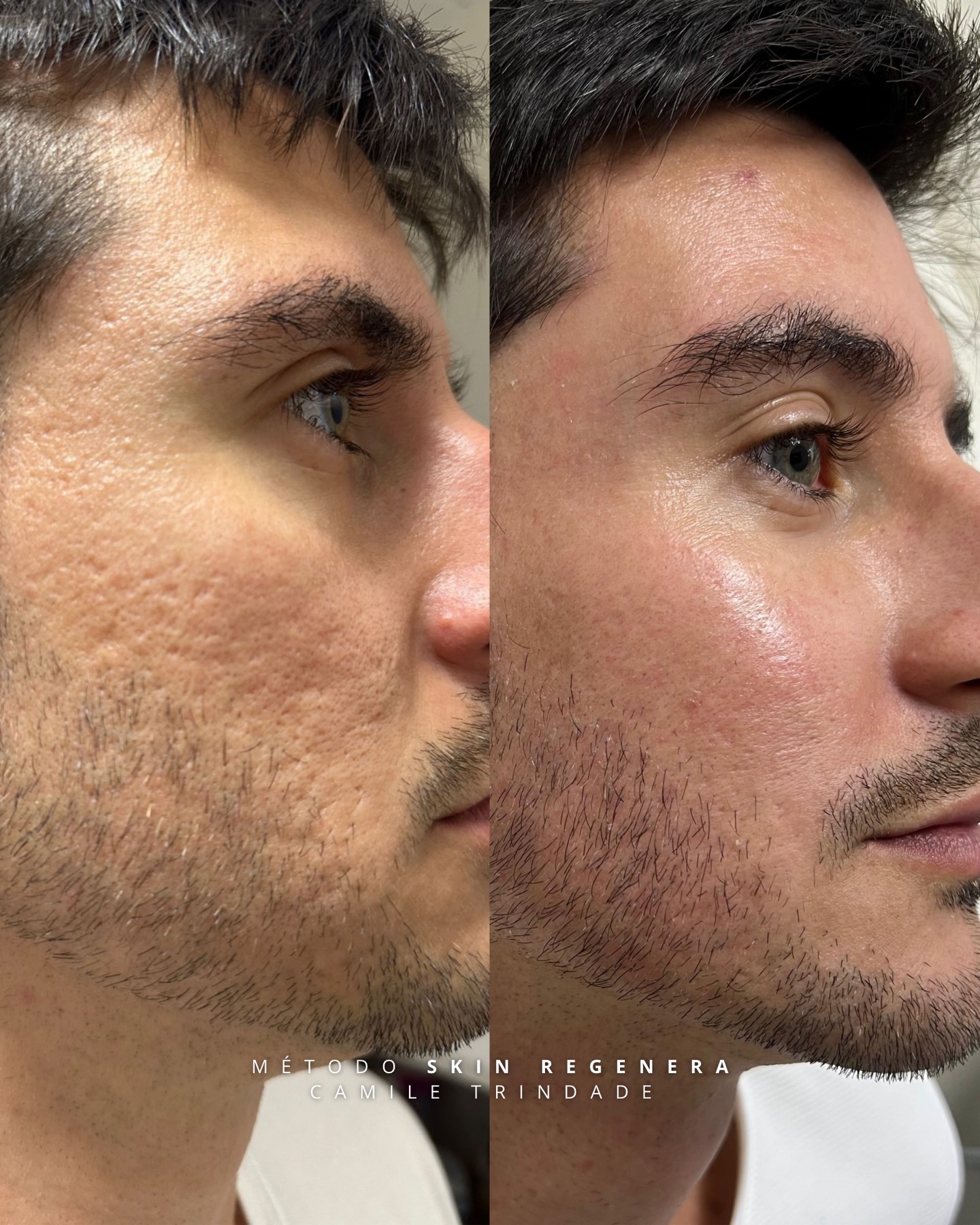 Dentista Camile Trindade Facebook ad: O paciente chegou querendo laser CO2… e eu…