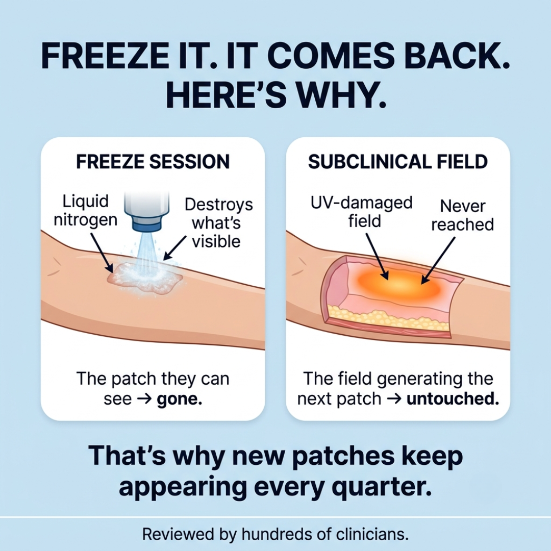 Actinic Keratosis Reset Facebook ad