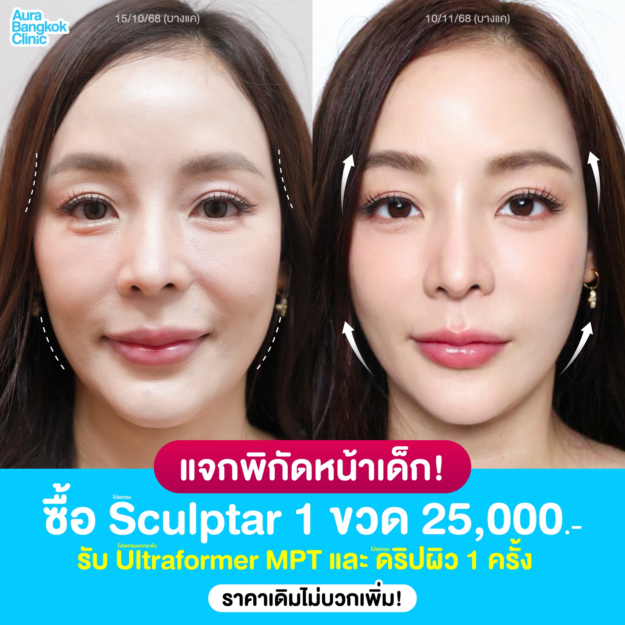 Aura Bangkok Clinic Facebook ad