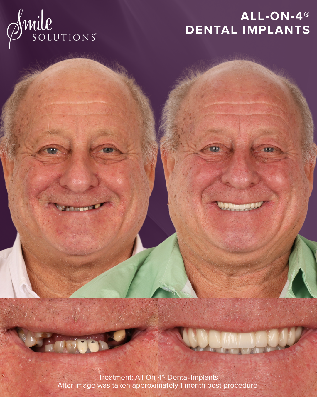 Smile Solutions- Melbourne's Home of Dentistry Facebook ad