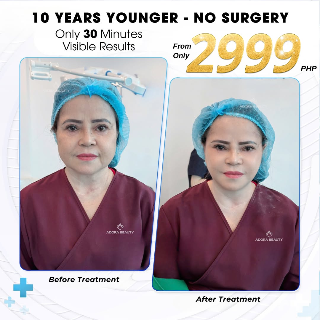 ADORA Beauty Center - Where beauty reigns Facebook ad