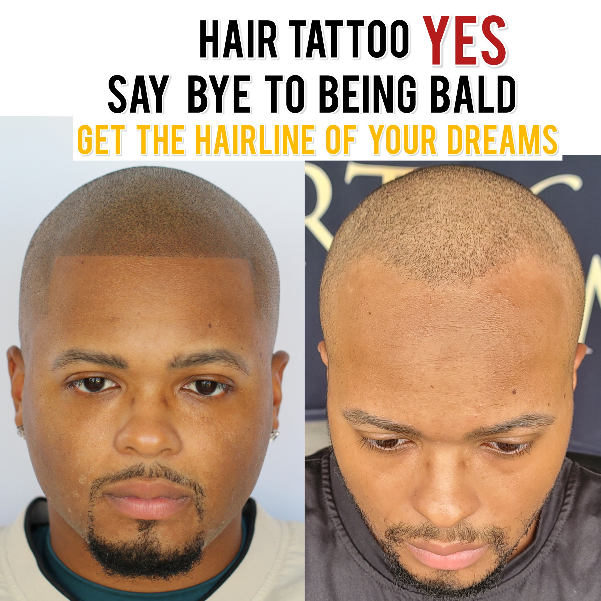 SCALP Micropigmentation Facebook ad