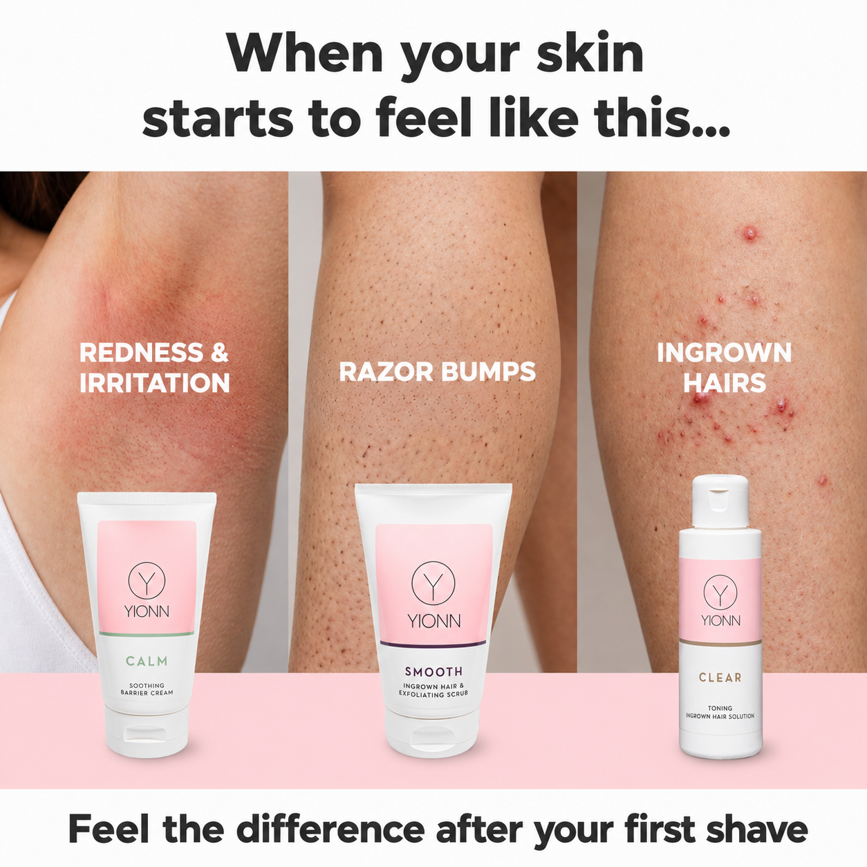 YIONN Facebook ad: What if it isn't your sensitive skin?