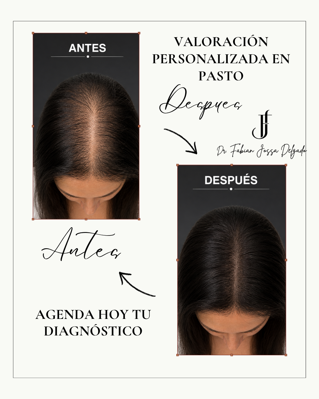Dr. Fabian Jossa Facebook ad: Recupera tu cabello a tiempo