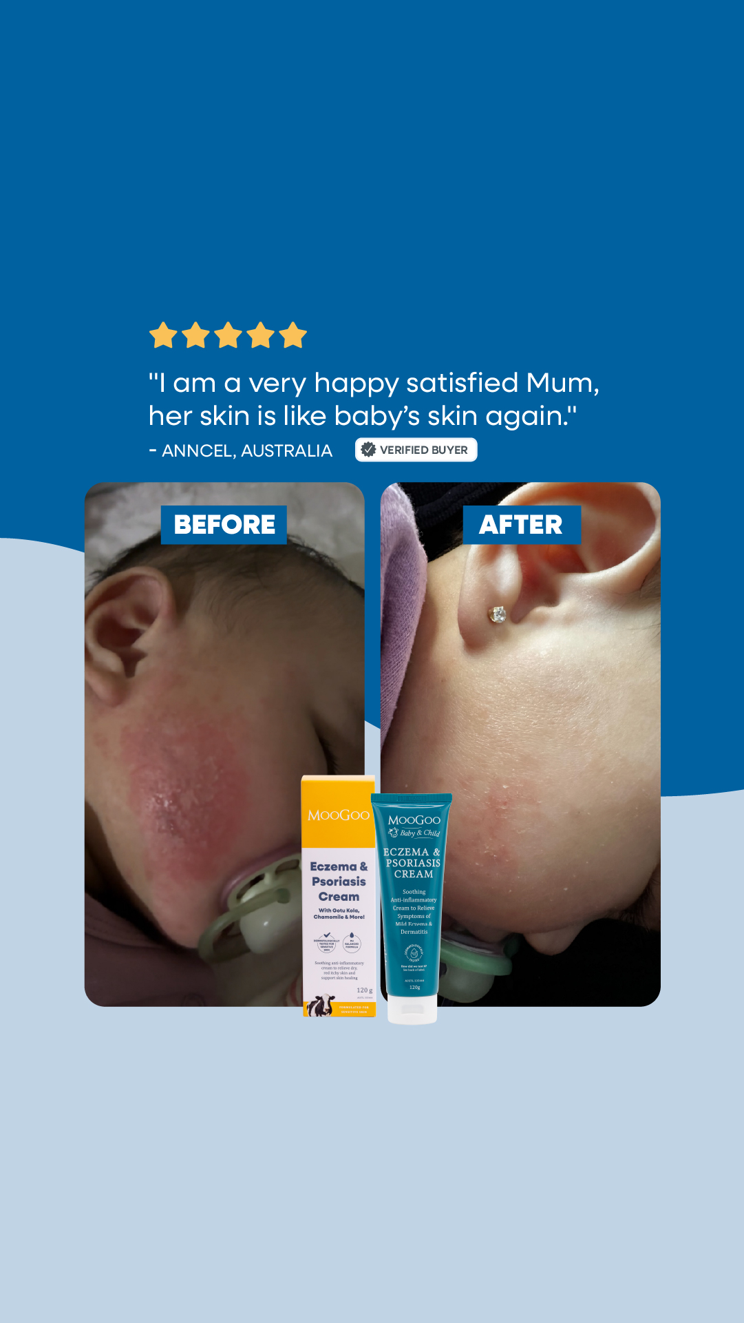MooGoo Skin Care Facebook ad