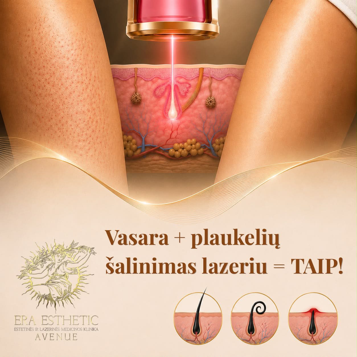 Era Esthetic - Lazerinės Dermatologijos Klinika Facebook ad: Plaukų šalinimas Aleksandrito lazeriu - ERA ESTHETIC