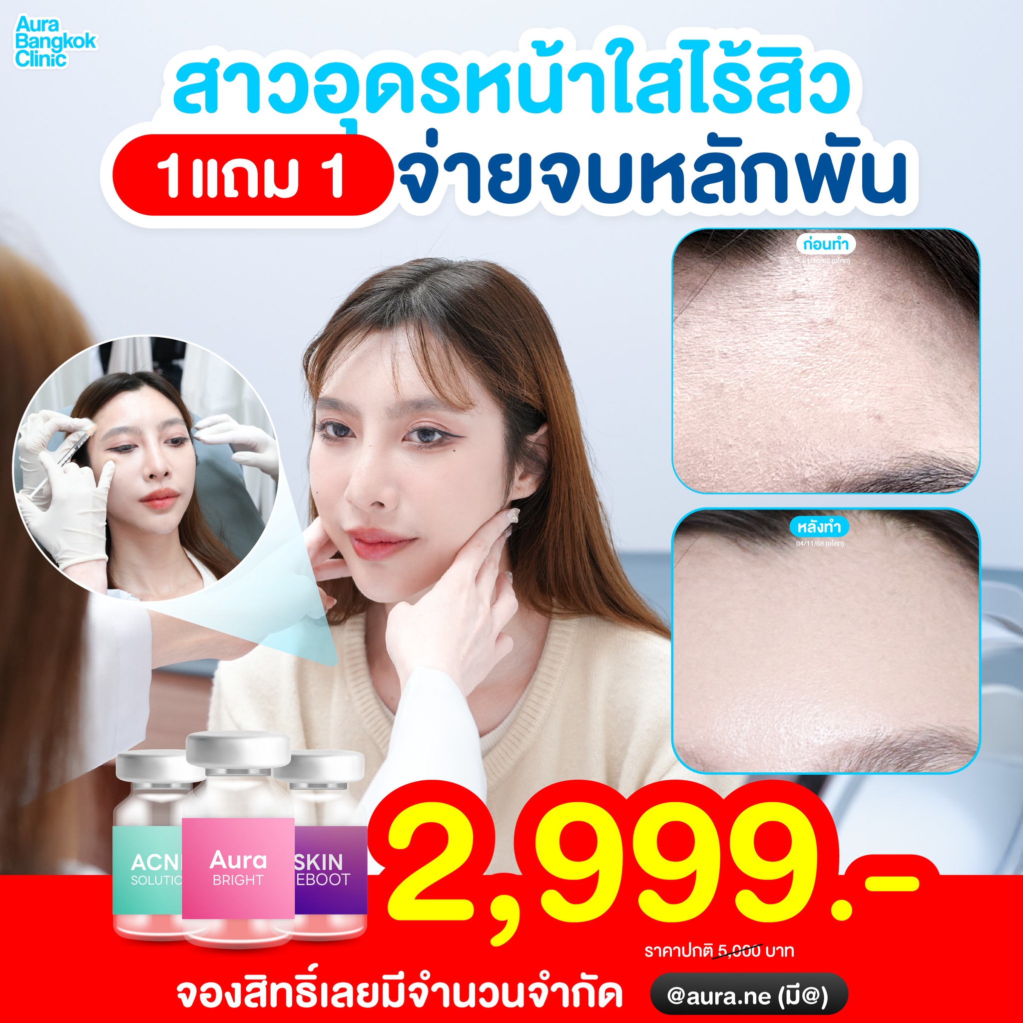 Aura Bangkok Clinic ออร่า แบงคอก คลินิก อุดร ขอนแก่น Facebook ad: สาวอุดรหน้าใสไร้สิว กู้หน้าหมอง ดีท็อกซ์ ปรับผิวแข็งแรง