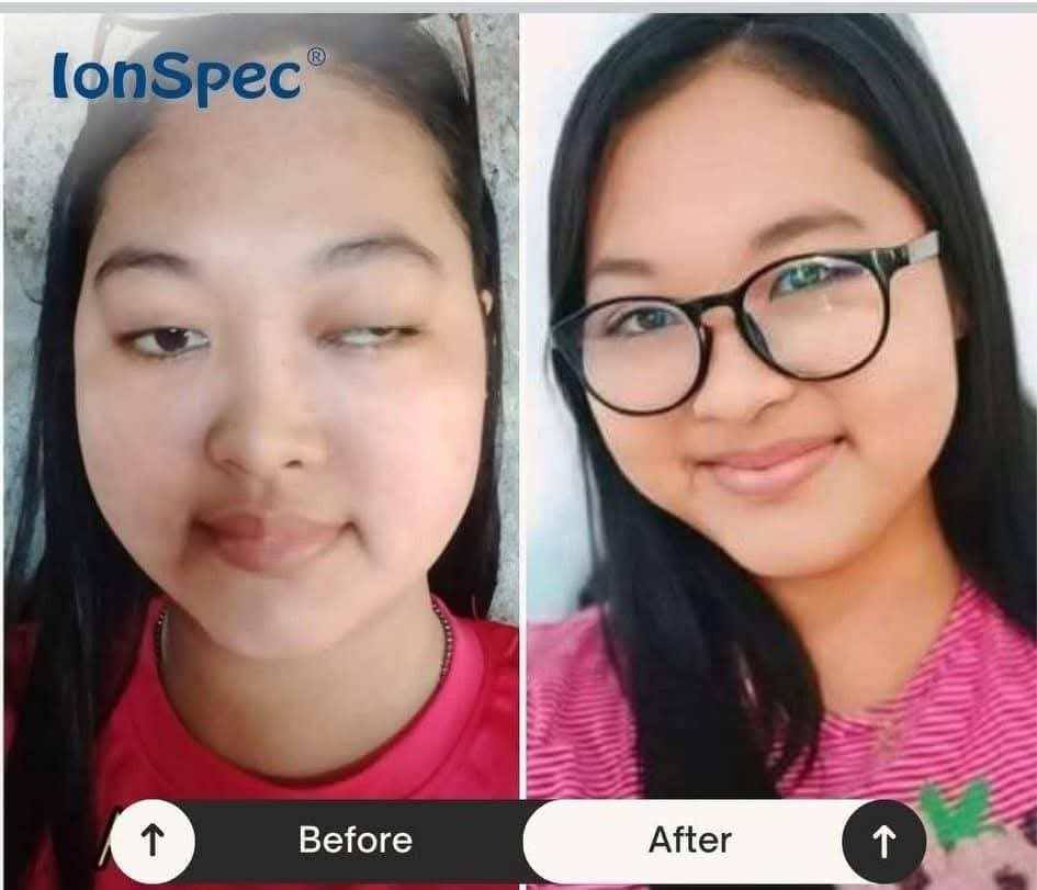 IonSpec Philippines Facebook ad: MAY EYE CONCERN KA BA GAYA NG