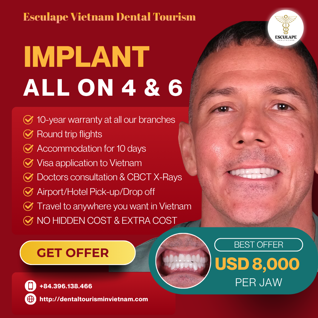Esculape - Vietnam Dental Tourism Facebook ad: GET FREE TREATMENT PLAN