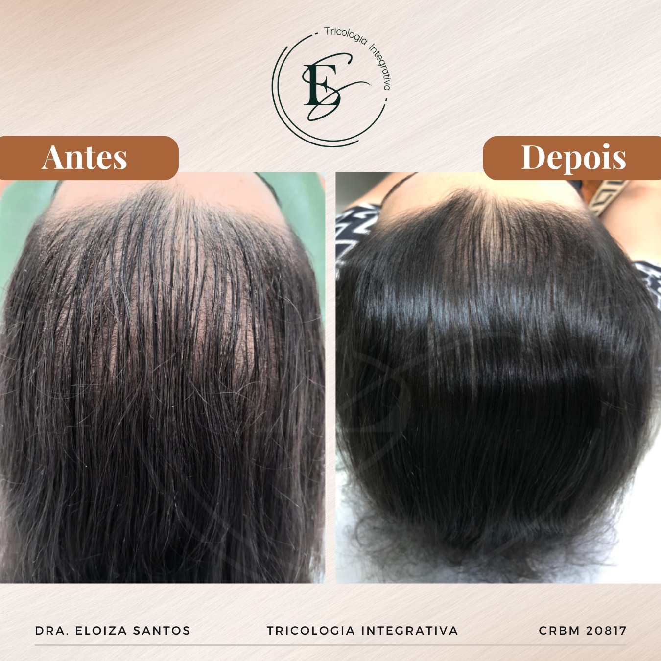 Eloiza Santos Tricologia Integrativa Facebook ad: Antes e depois que inspira confiança!