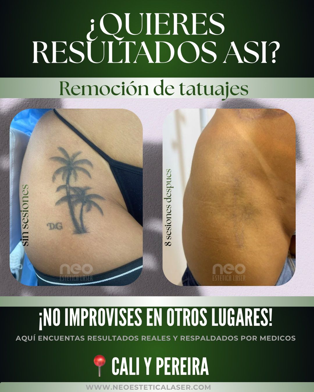 Neo Láser Dermatológica Facebook ad: ¿Ese tatuaje ya no representa quién eres?