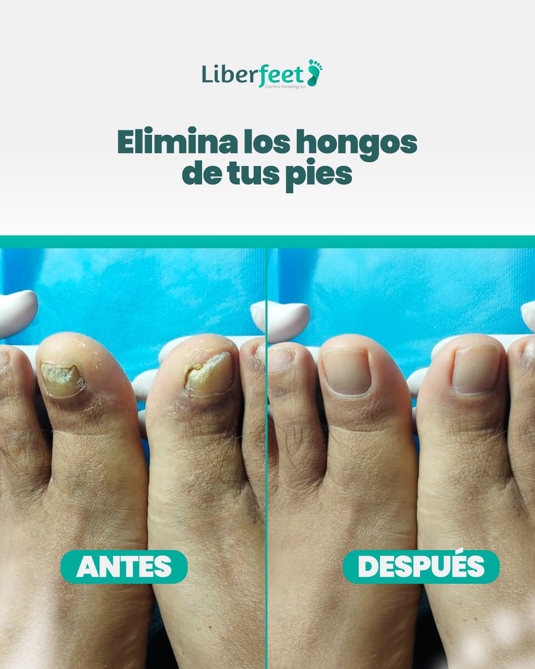 Liberfeet - Centro Podológico Facebook ad from Jul 6, 2026