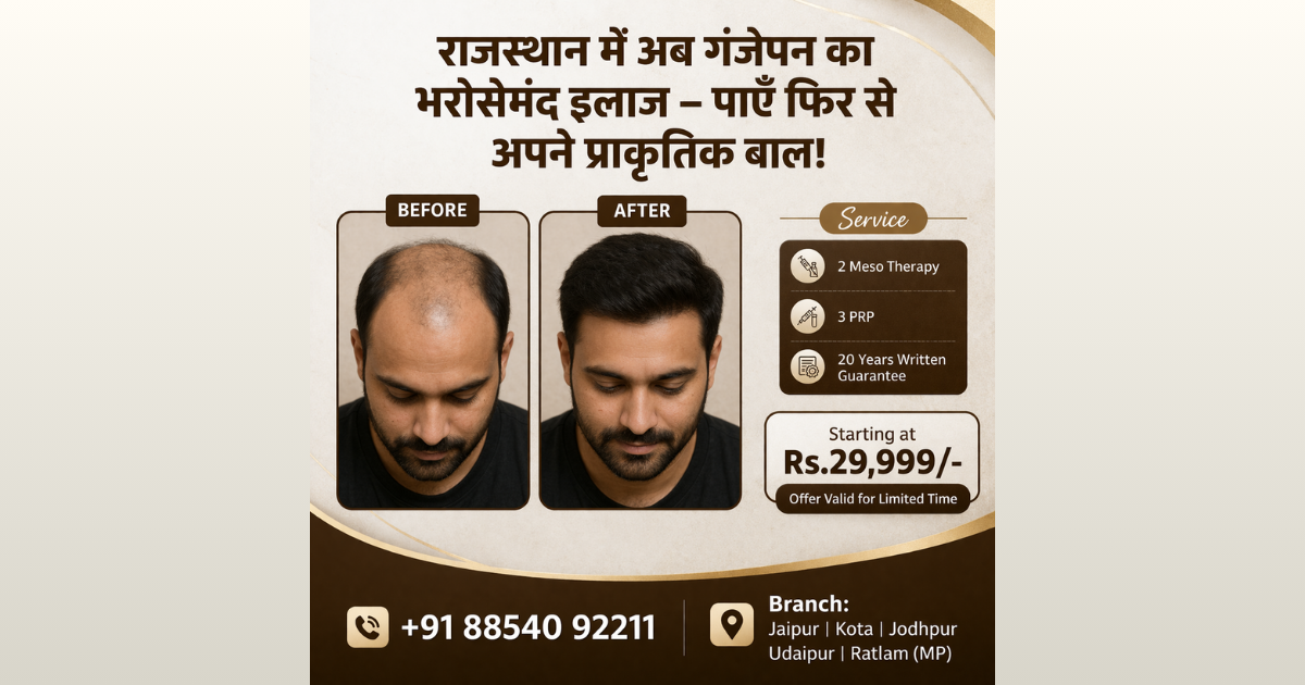 Best hair Transplant in Rajsthan-Udaypur-Kota,Jodhpur,Jaipur Facebook ad
