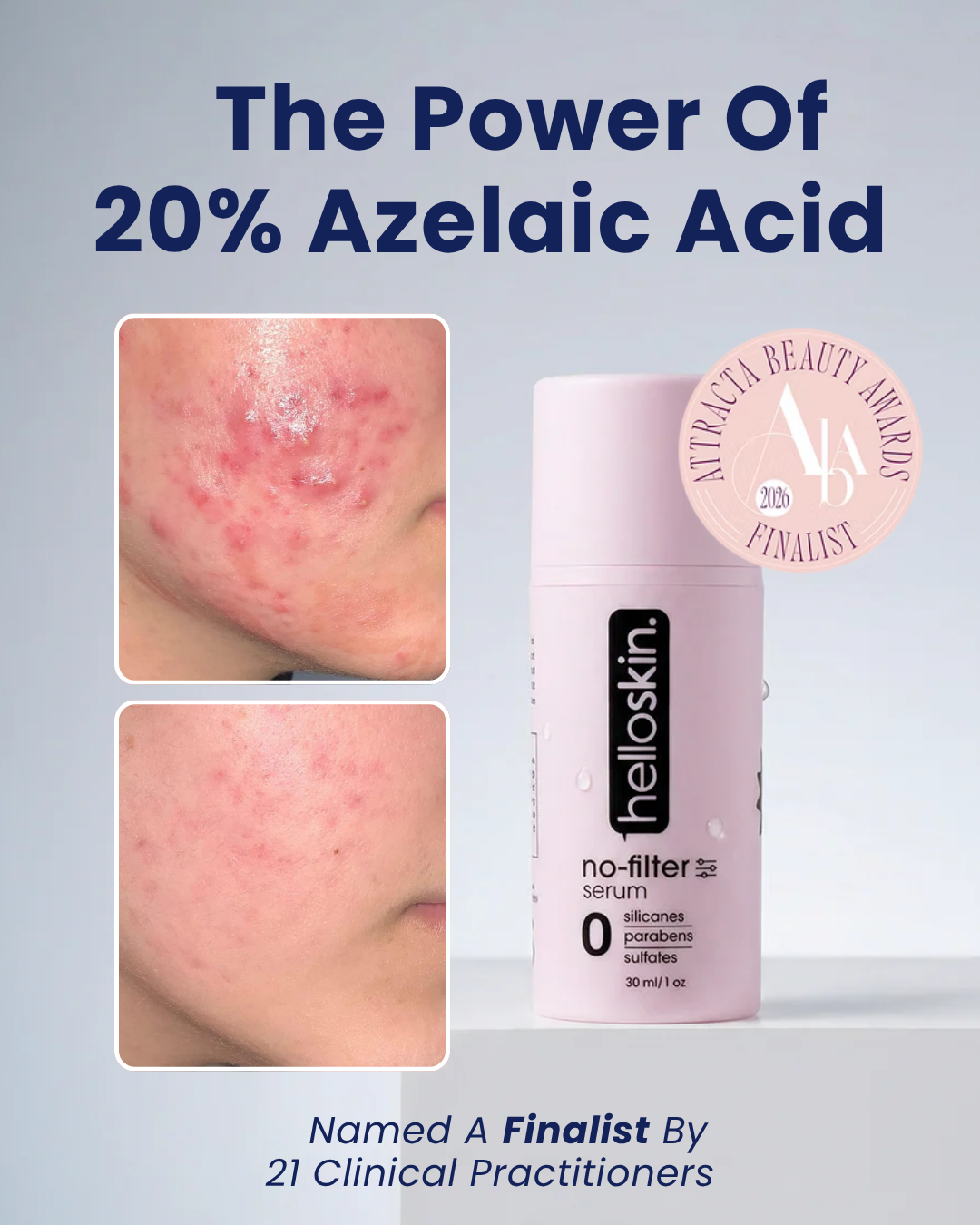 Helloskin Facebook ad