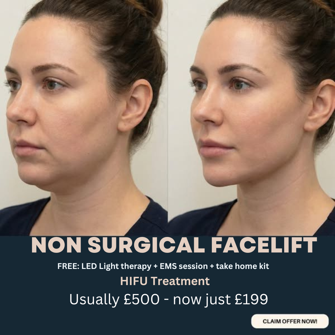 Lunar Aesthetics Facebook ad: Non-Surgical Facelift - Now just £199 (Was £499)