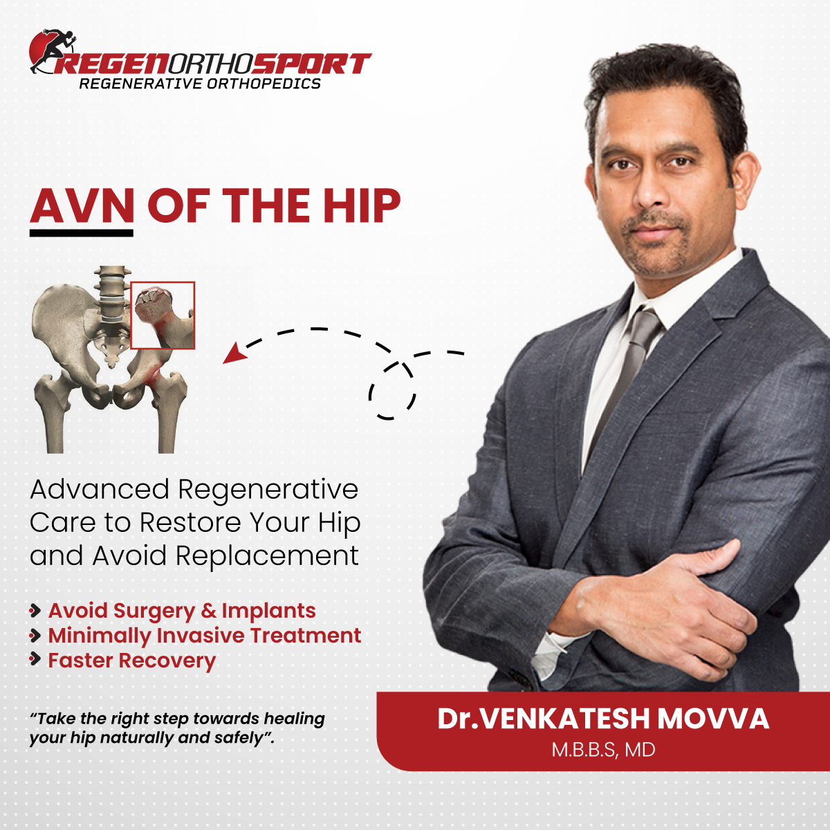 Regenorthosport Bengaluru Facebook ad: AVN Hip Treatment Without Surgery