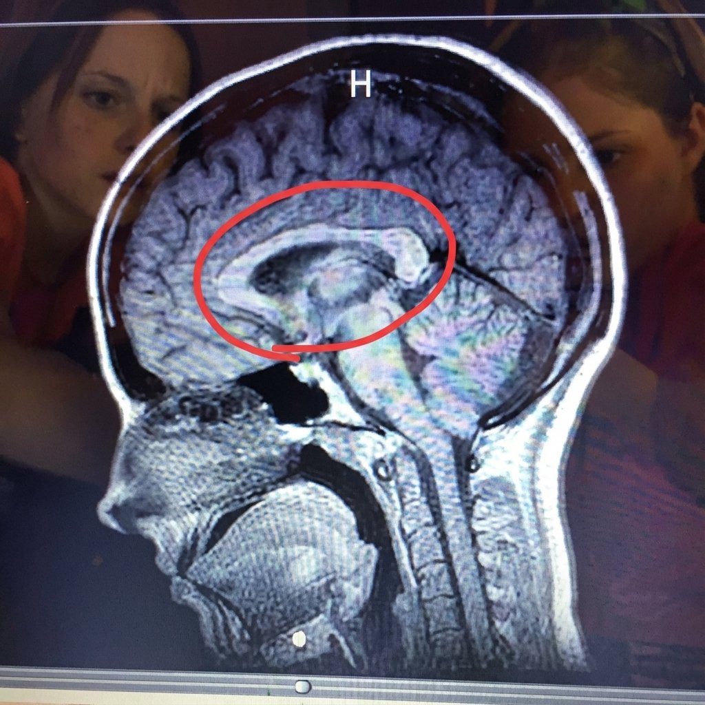 The Migraine Nightshift Report Facebook ad