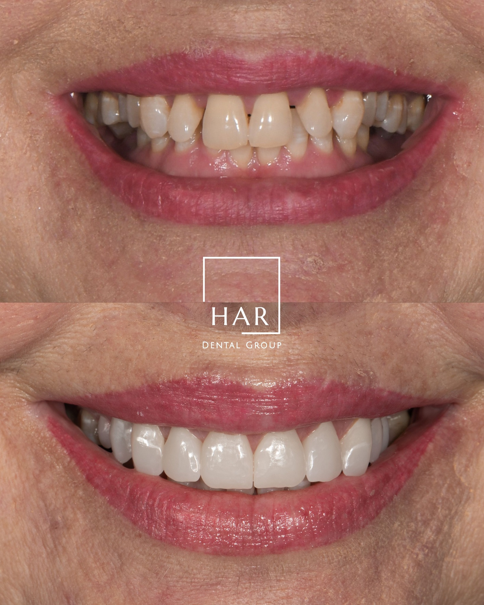 Amarillo Dental & Implant Center Facebook ad