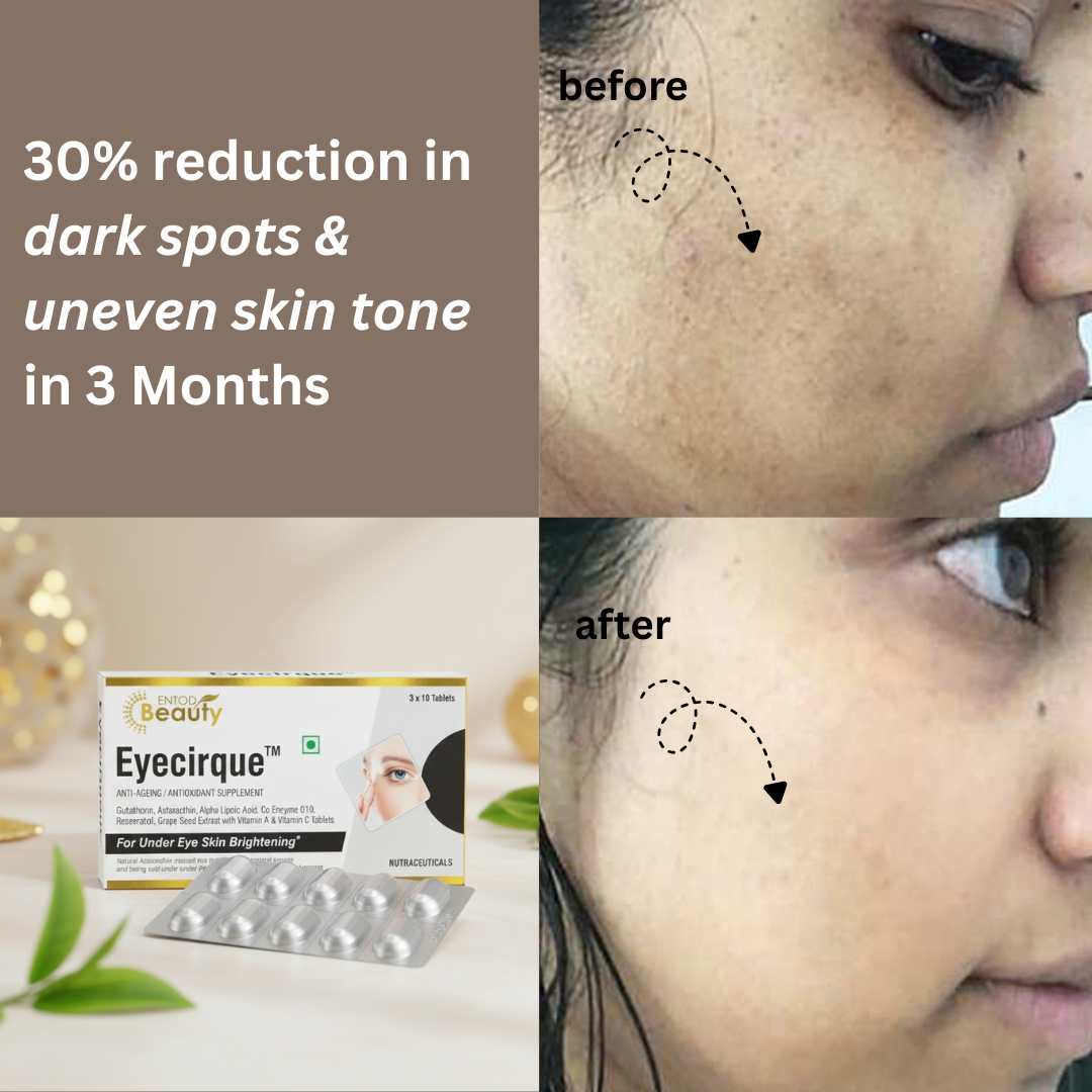 Eyecirque Eye Care & Eye Beauty Facebook ad