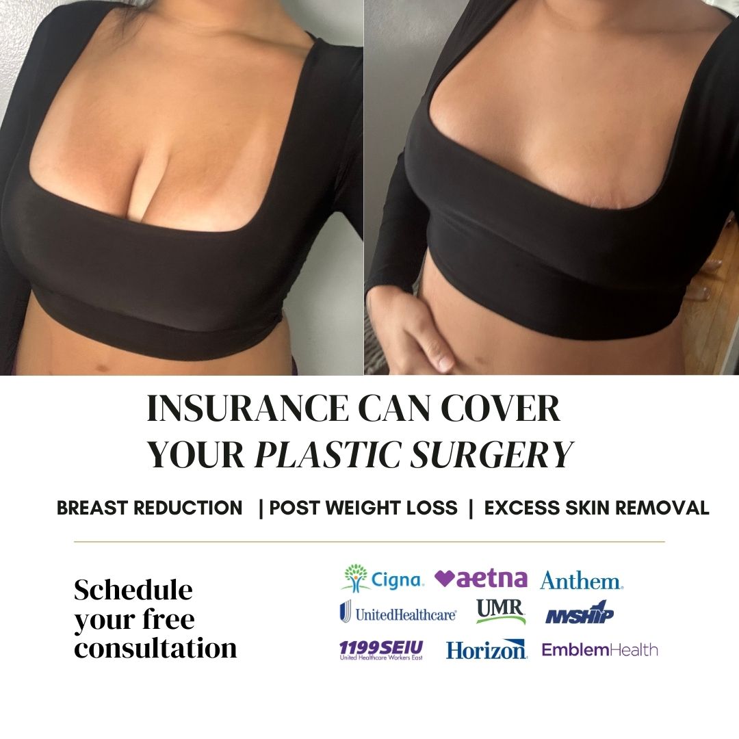 Dr. Itay Wiser MD - Breast Plastic, Cosmetic & Reconstructive Surgeon Facebook ad
