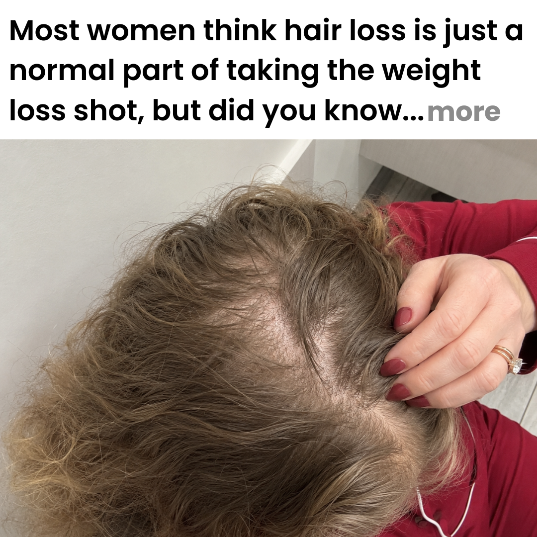 Shots & Shedding Insiders Facebook ad: Read if your hair is falling out
