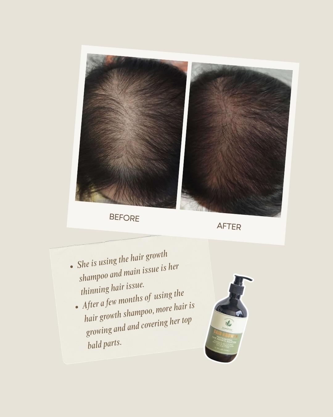 Fayrebeauty Facebook ad: Hair fall worries?
