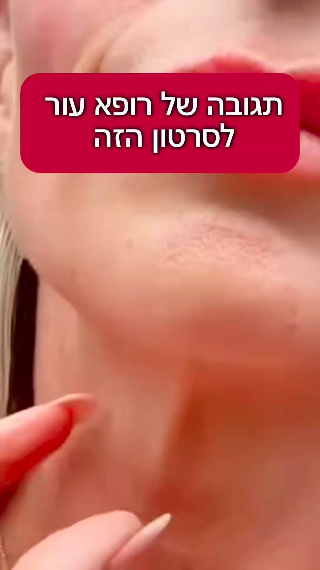 Breathypro Facebook ad: החזירי לעור שלך את המראה הבריא תוך 3 שבועות!