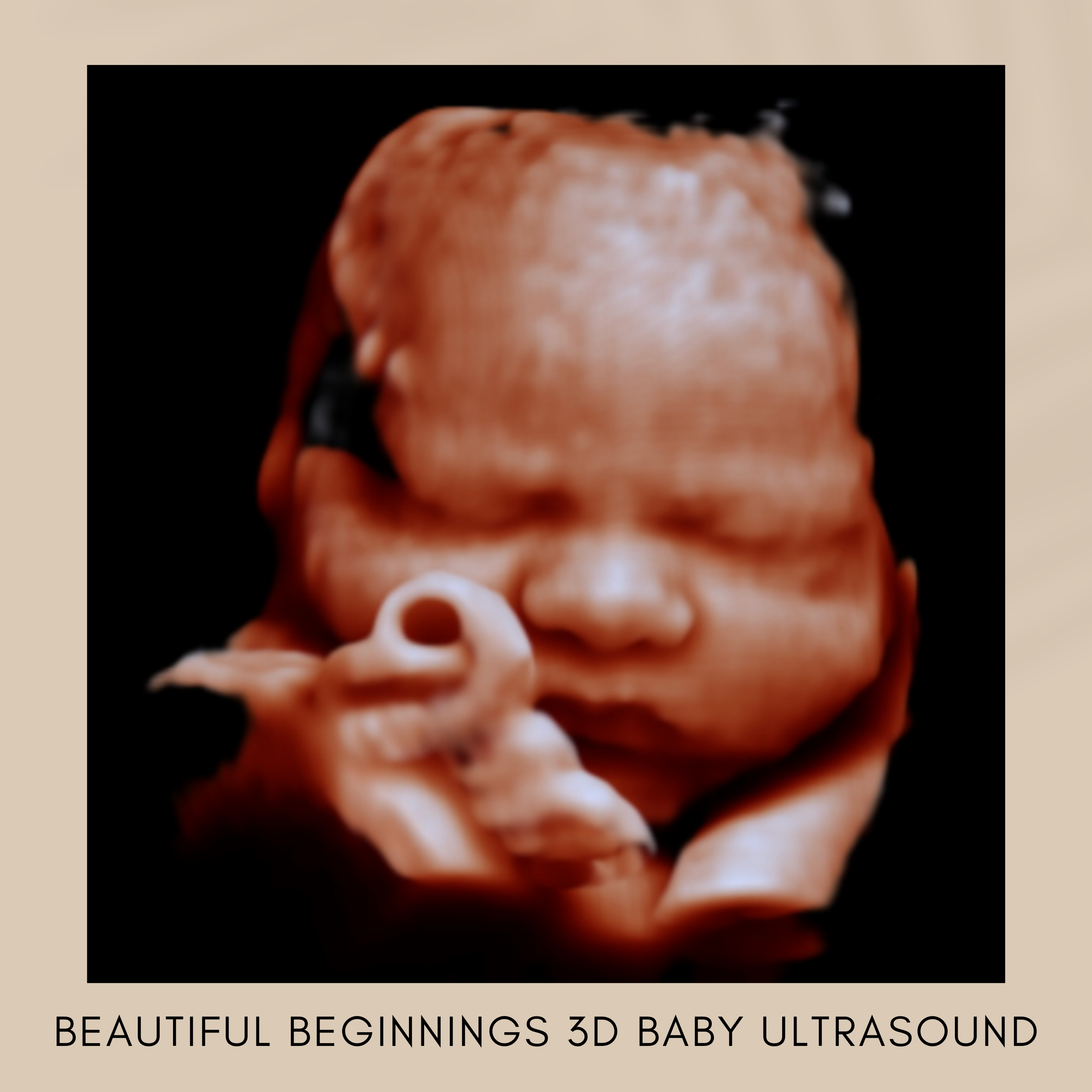 Beautiful Beginnings 3D Baby Ultrasound Facebook ad: 3D Baby Gender Scans Perth WA