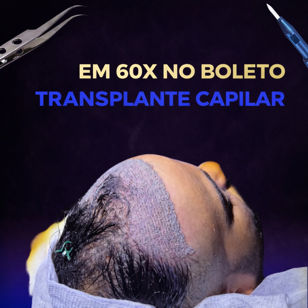 Transplante Capilar FUE Facebook ad: Você olha no espelho e já não se reconhece por causa da…