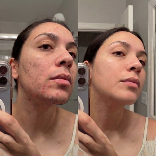 Dr. Hannah Jacob Facebook ad