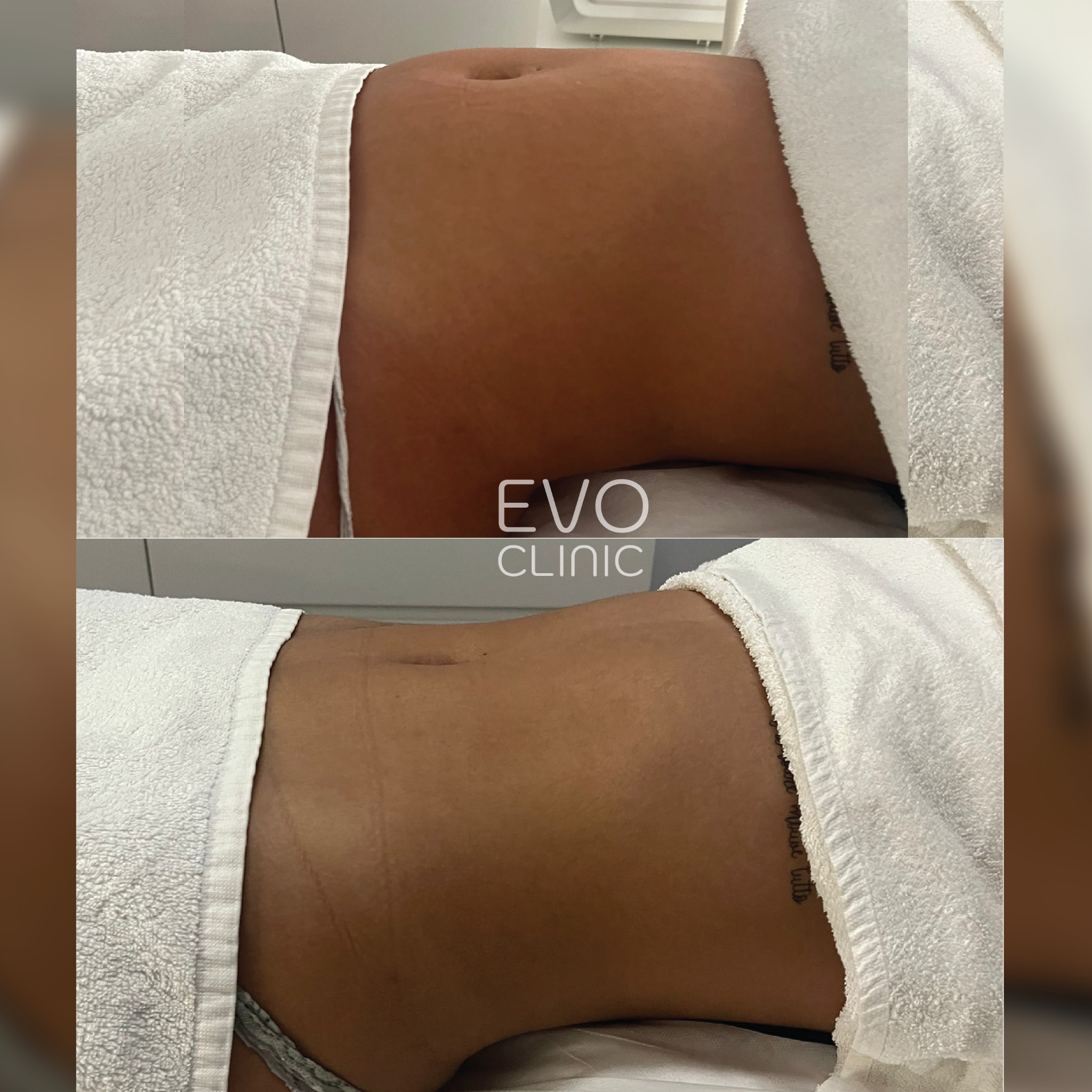 Evoclinic Beloura Facebook ad