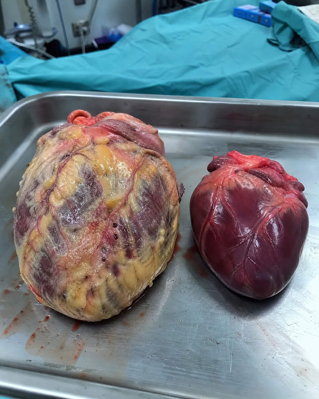 The Heart Health Project  Facebook ad
