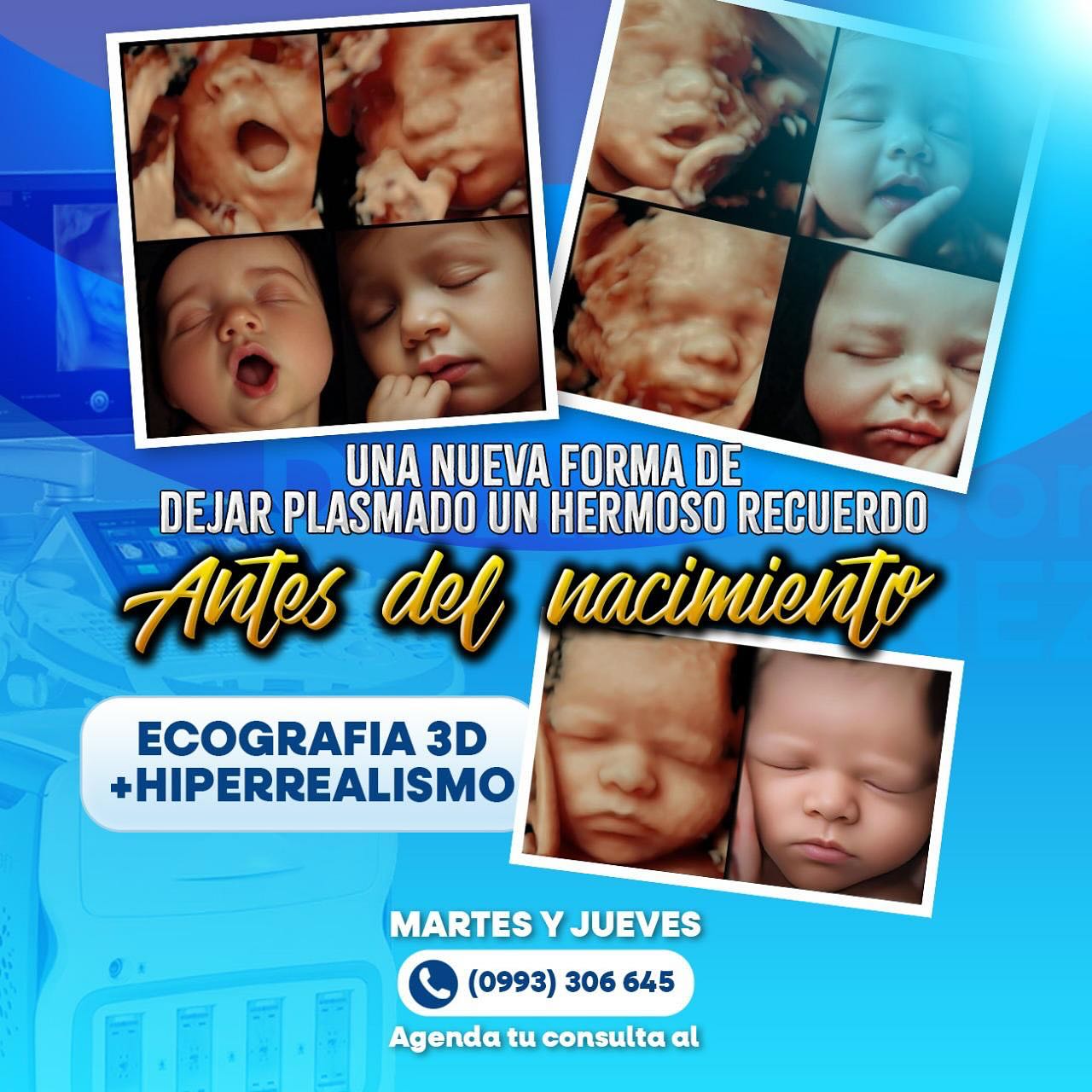 Dr Anderson Martinez Facebook ad: Cupos limitados para tu ecografía 3D hiperrealista este…