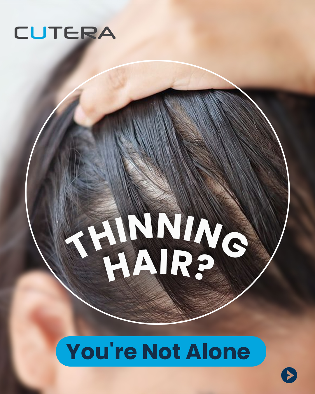 Cutera Aesthetics Facebook ad: Thinning hair? Let your body lead the recovery