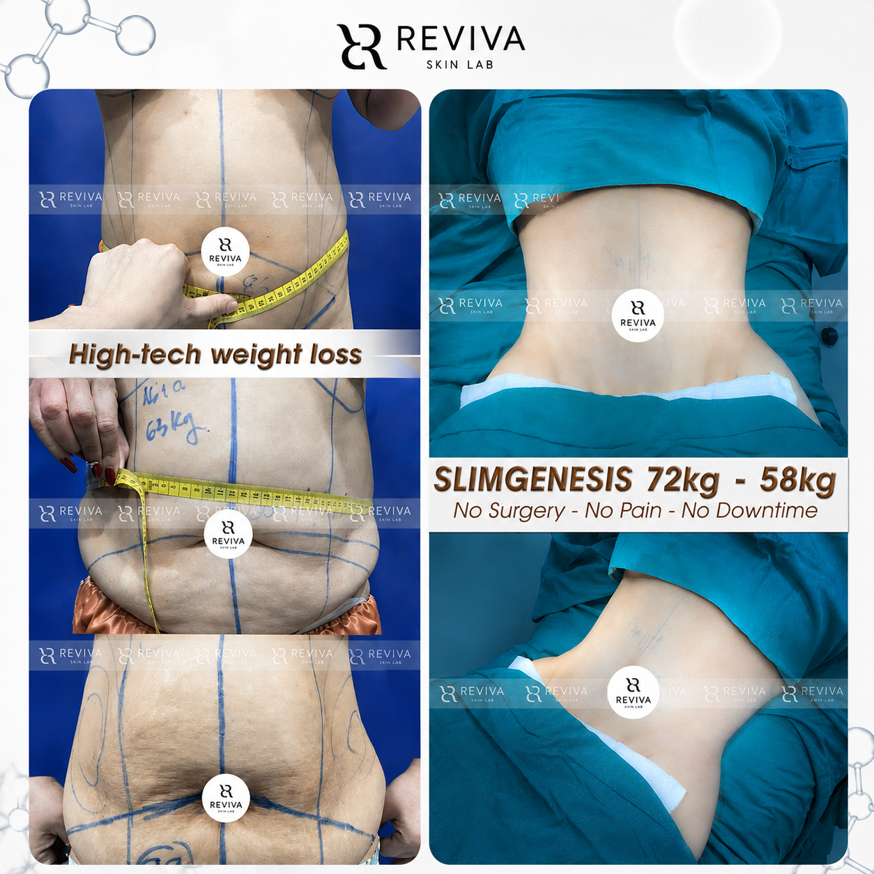Reviva Aesthetic & Beauty Clinic - Iloilo Branch Facebook ad from Aug 8, 2026