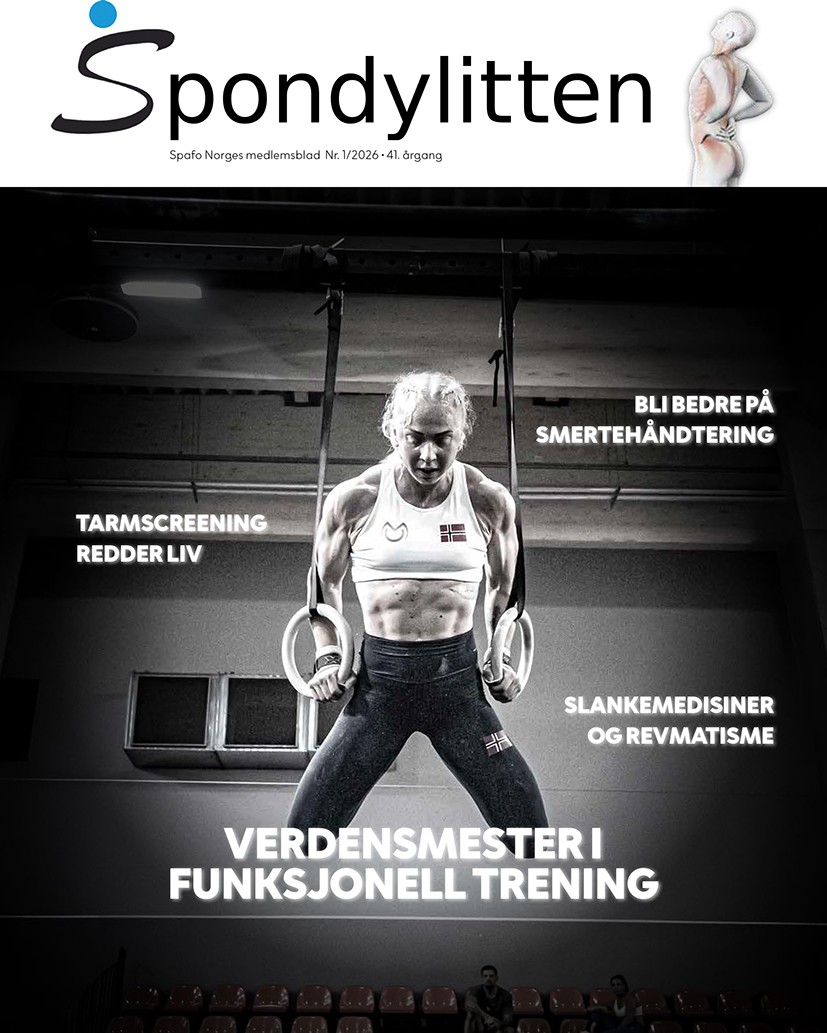 Spafo Norge - Spondyloartrittforbundet Norge Facebook ad