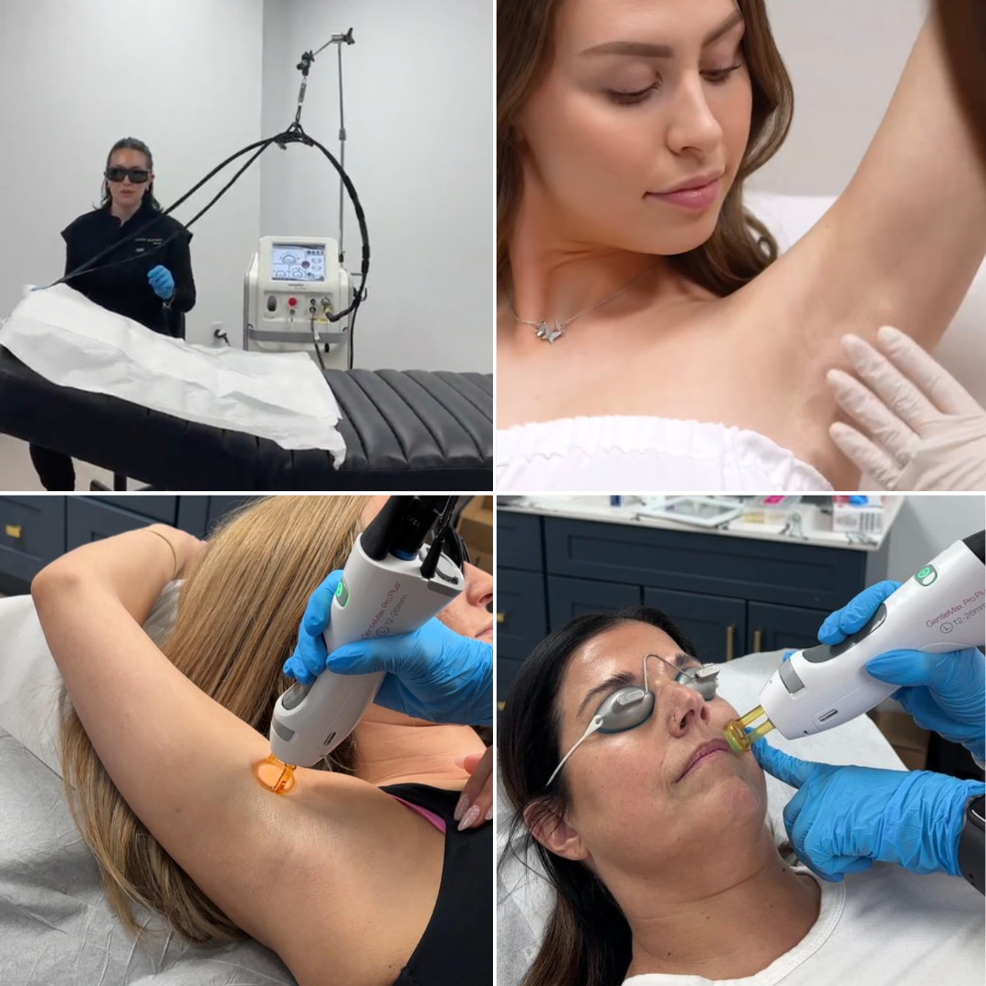 Beauty Matched Med Spa Facebook ad: Unlimited Laser Hair Removal in Sarnia!