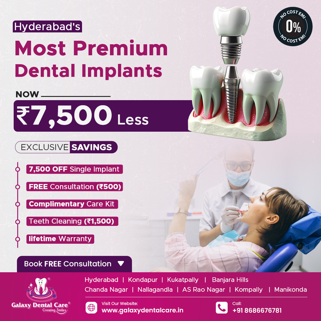 Galaxy Dental Care Facebook ad